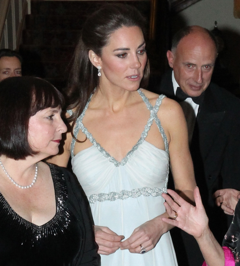 Герцогиня Кейт не носит разоренного переплетения, у нее просто шрам на голове